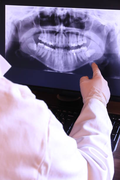 Best Emergency Tooth Extraction in Loretto, TN